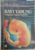 Bayi Tabung: Tinjauan Aspek Hukum